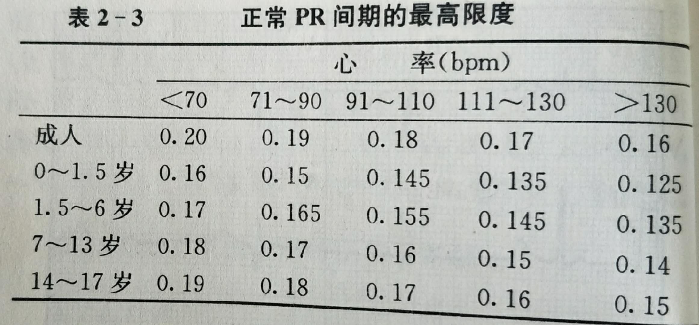 心电图多少算正常（心电图多少算正常图片）-第2张图片-华展网