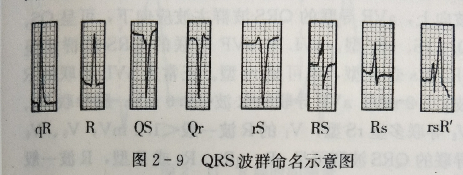 心电图多少算正常（心电图多少算正常图片）-第3张图片-华展网