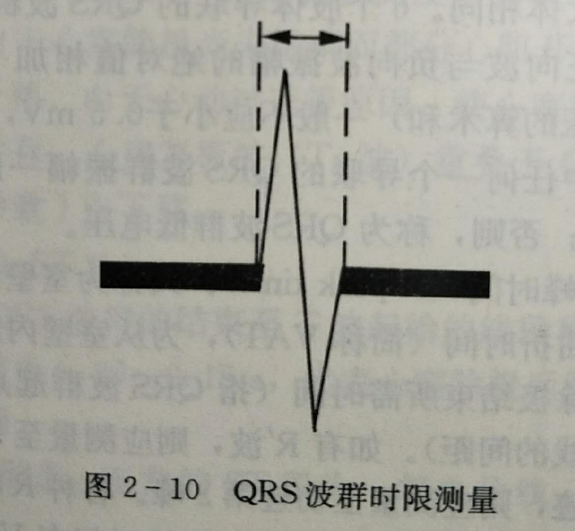 心电图多少算正常（心电图多少算正常图片）-第4张图片-华展网