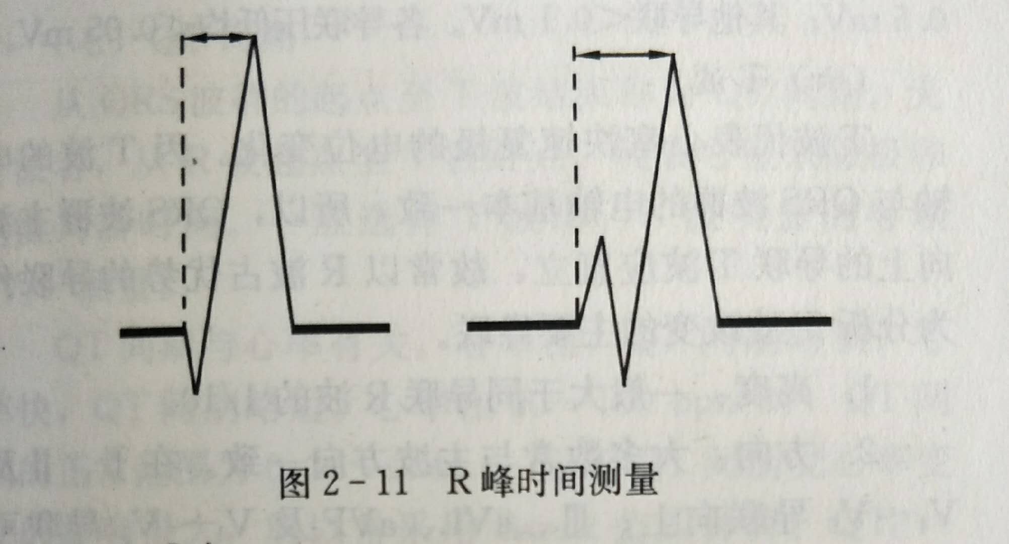 心电图多少算正常（心电图多少算正常图片）-第5张图片-华展网