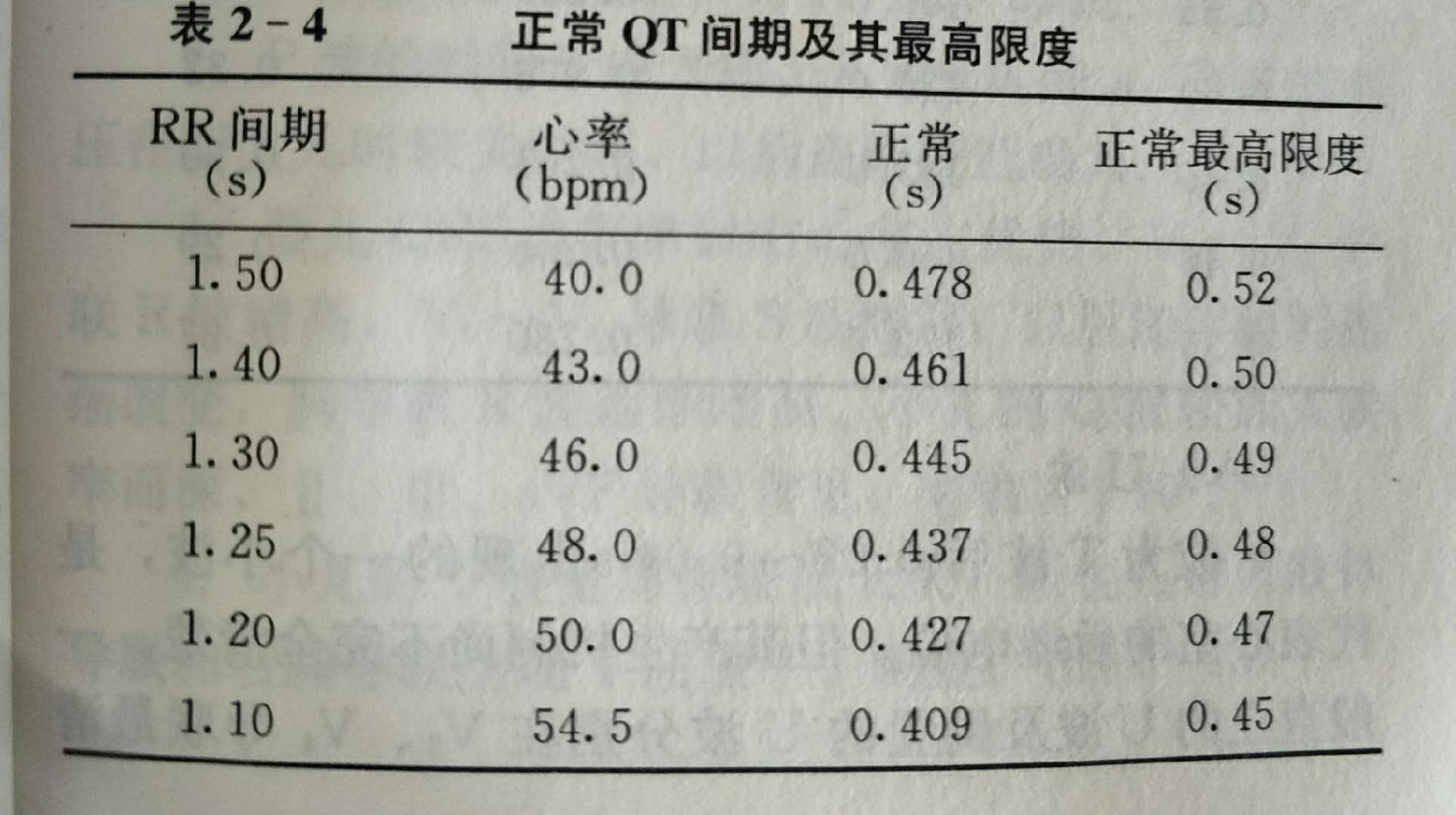 心电图多少算正常（心电图多少算正常图片）-第7张图片-华展网