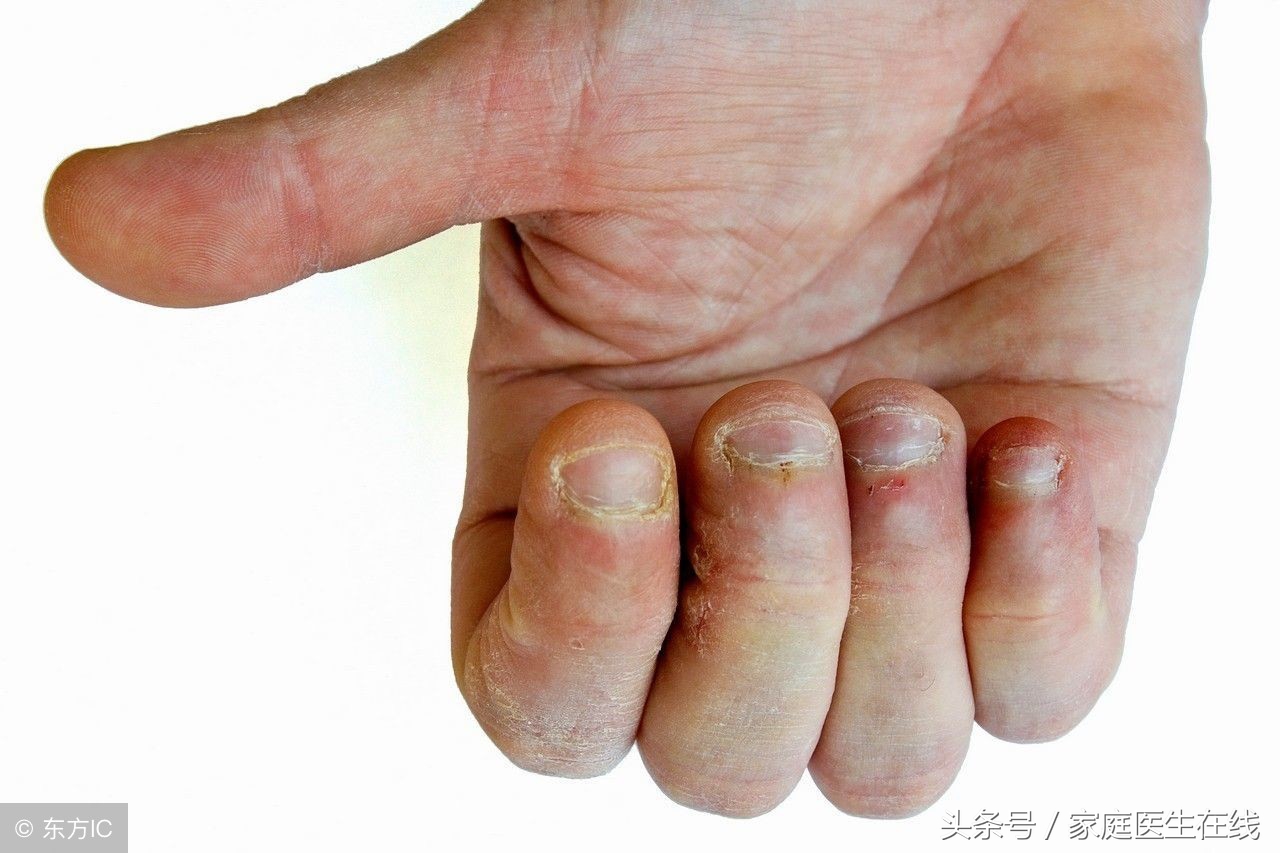 男人指甲发黄,暗示着肾透支了,要多补充这个营养素