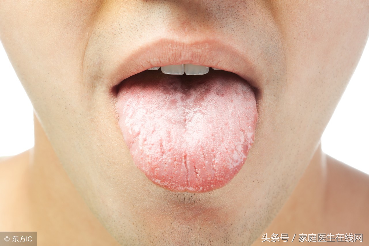 不小心咬伤舌头的处理方法和注意事项