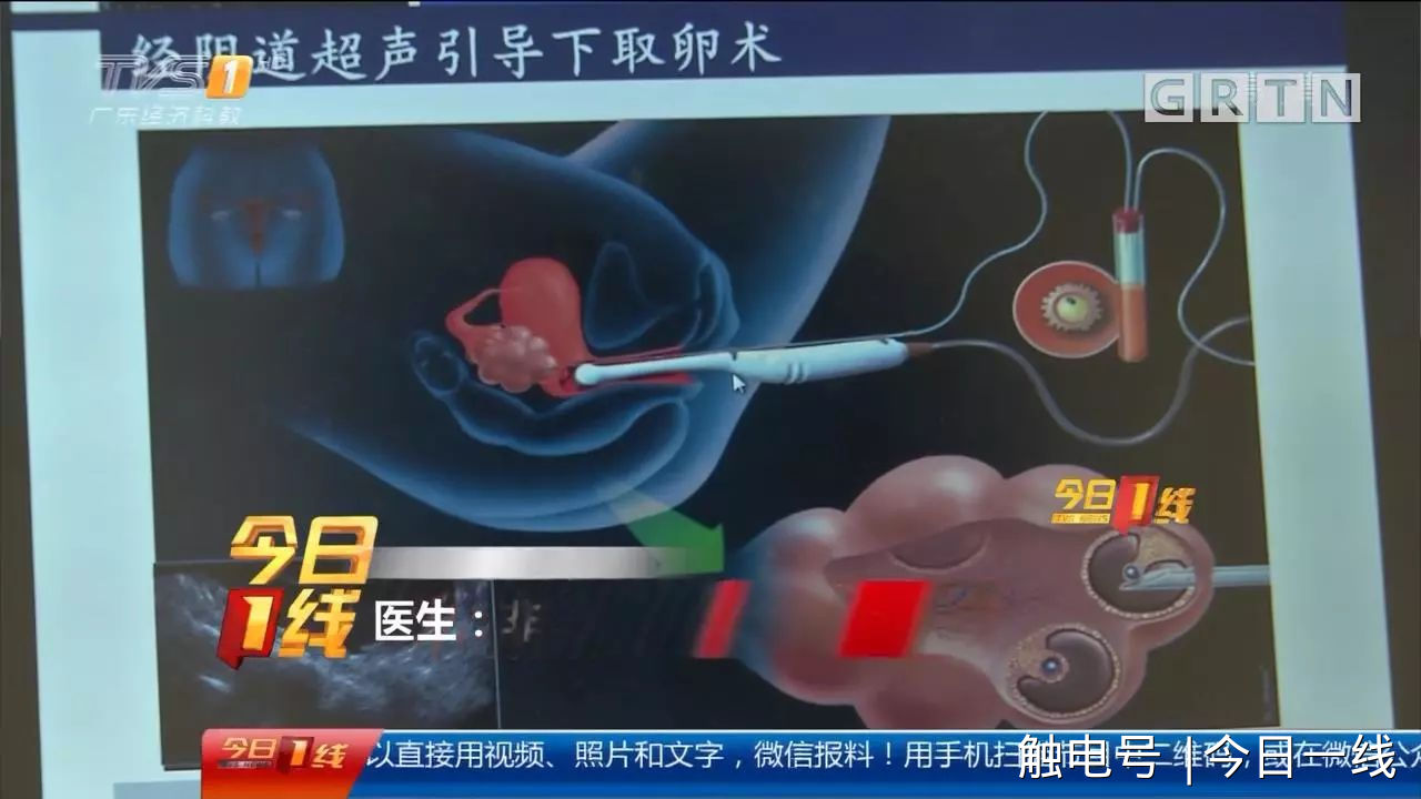 地下代孕黑链调查：14岁少女被骗卖卵，85万一条龙包成功