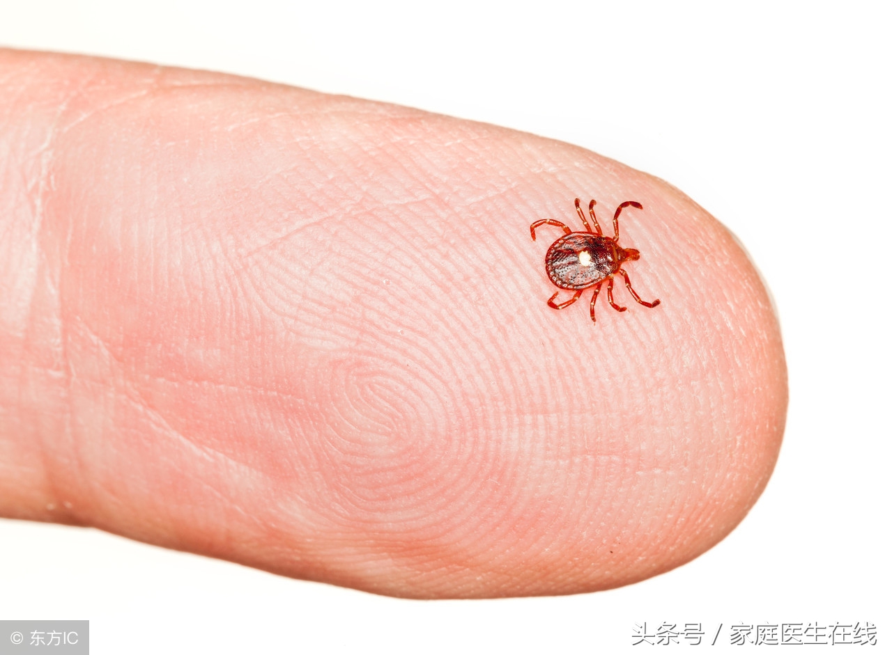 被蜱虫叮咬后怎么办夏季如何防止被蜱虫叮咬