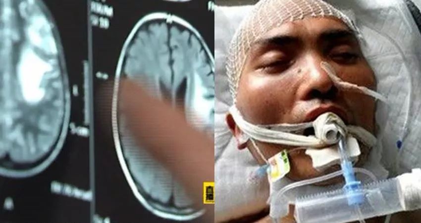 这种食脑寄生虫就潜伏在你身边