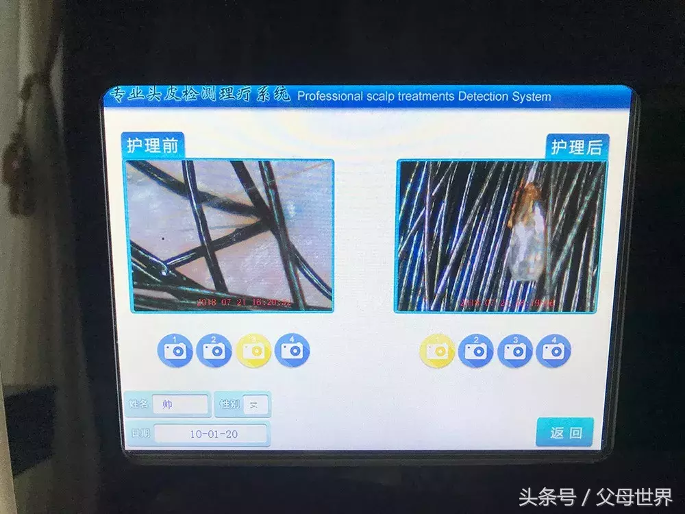 天天给女儿洗头,竟然还长了满头虱子!原因你也忽略过……