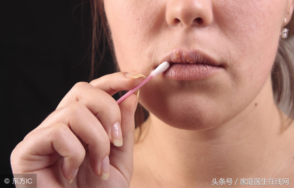 嘴角长的小水泡是怎么回事？不外乎是这3个原因引起