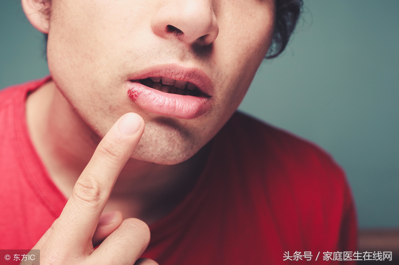 嘴角长的小水泡是怎么回事？不外乎是这3个原因引起