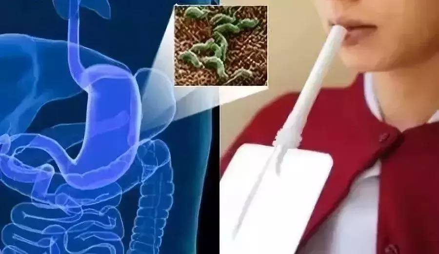 C13呼气试验是检查啥的?管不好嘴易得这种病!