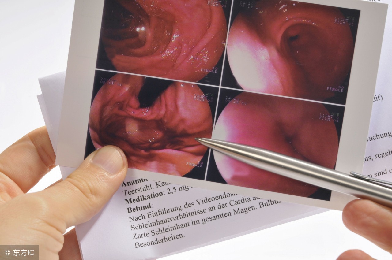 做食道镜检查需要多少钱?一般不会超过这个数值,别过于担心
