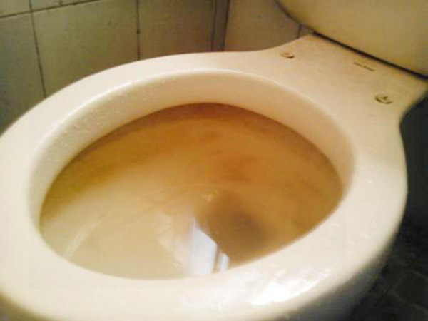 马桶里面厚厚的尿垢该怎么处理，马桶里面厚厚的尿垢该怎么处理？