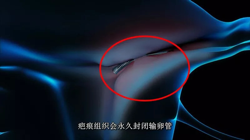 可怕！这些尖端医疗真相你还不知道