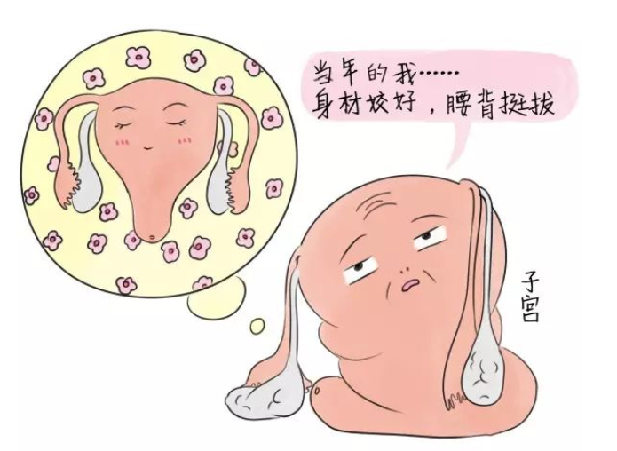 子宫脱垂并非产妇"专利"!专家提醒:女性这些情况须警惕!