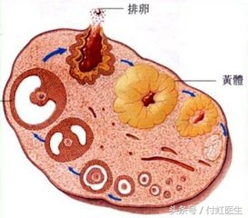 黄体破裂手术费用大概多少(同房后酿成的“血案”“黄体破裂”，医生却不给我手术？)