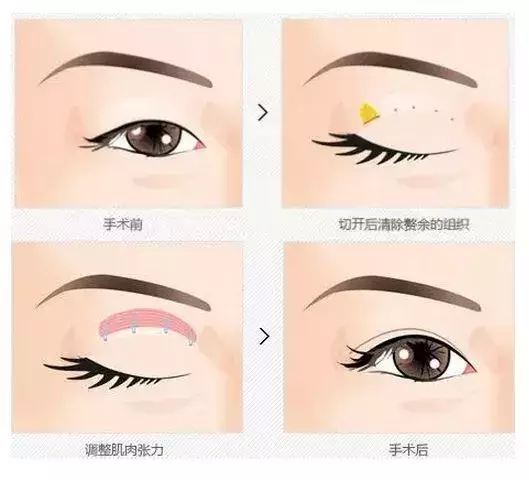 癌胚抗原为啥高?拔牙要打麻药吗?胆囊息肉会癌变?贫血吃啥药?