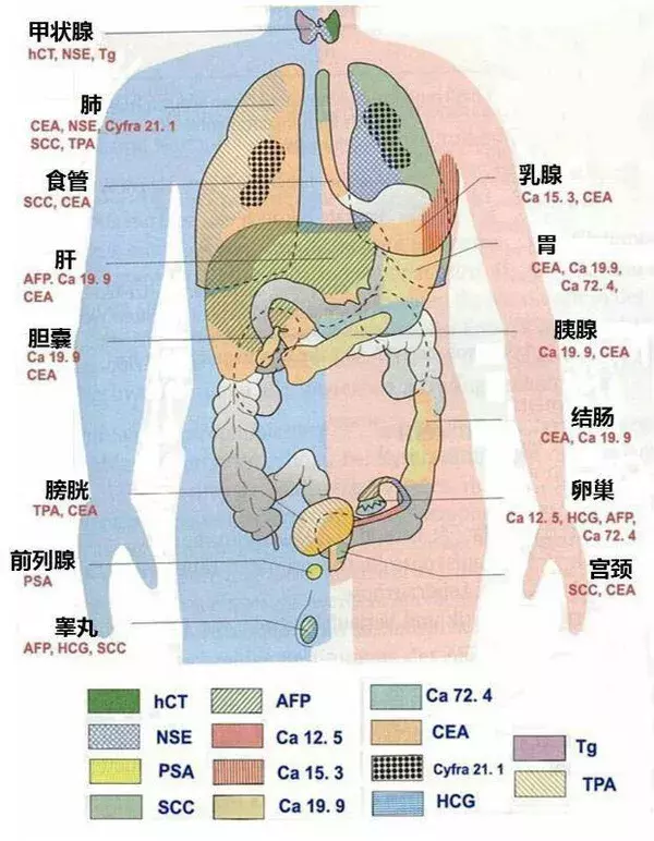 癌胚抗原为啥高?拔牙要打麻药吗?胆囊息肉会癌变?贫血吃啥药?