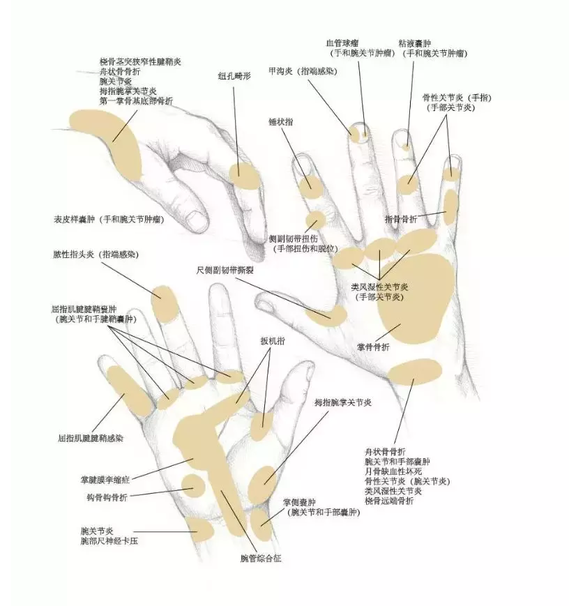 癌胚抗原为啥高？拔牙要打麻药吗？胆囊息肉会癌变？贫血吃啥药？