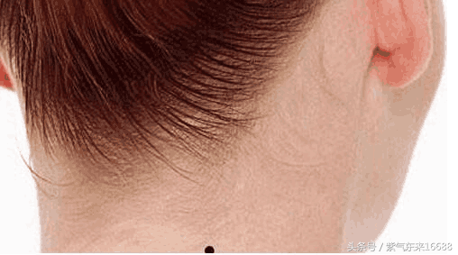 长痣面相图 女性脖子上长痣面相图_达一风水网