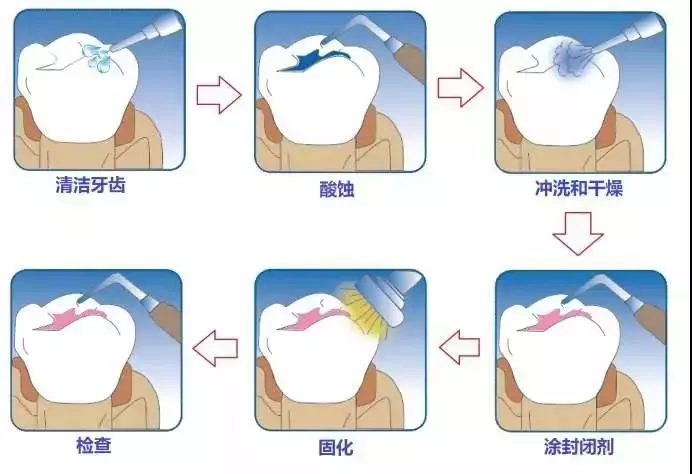 牙医建议：宝宝牙齿的这12个问题很重要，家长一定要知道！