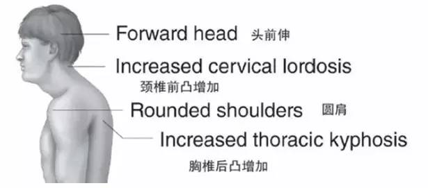 如何练羽毛球杀球(杀球的力量训练方法（一）)