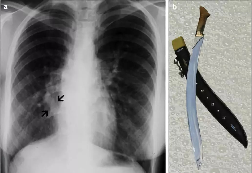梨形心见于()靴型心见于()(梨形心和靴形心常见于)-友友