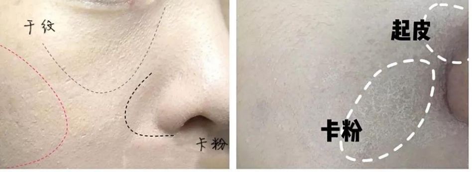 粉底液卡粉浮粉的原因是什么？简单3步，拥有服帖、干净的底妆