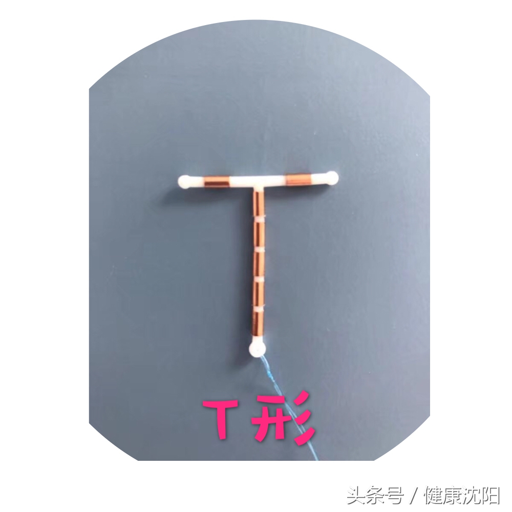 带铜t形iud:按宫腔形态设计,呈t字形,以聚乙烯为支架,在纵臂或横臂上
