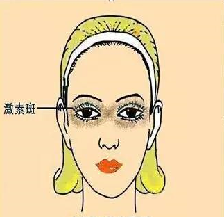 脸上斑的位置图解,脸上斑的位置图解美容
