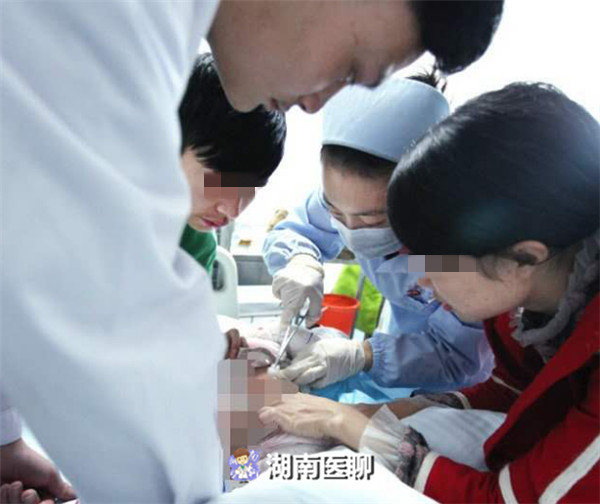 小阴唇或臀部两侧不对称是怎么回事？