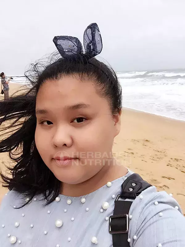 从214斤到109斤,90后小姐姐亲身经验告诉你,减肥=整容!
