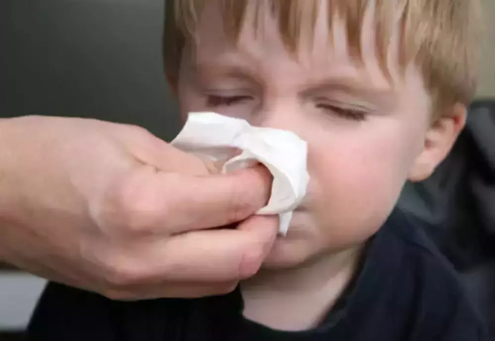 孩子经常流鼻血是因为患上白血病?正确的预防和处理方法全攻略