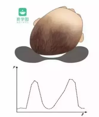 宝宝偏头、歪头怎么办？抓住黄金期，调整还来得及