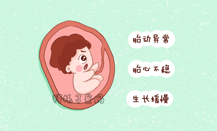 胎儿缺氧的3种表现，你发现没？孕期如何预防胎儿缺氧？