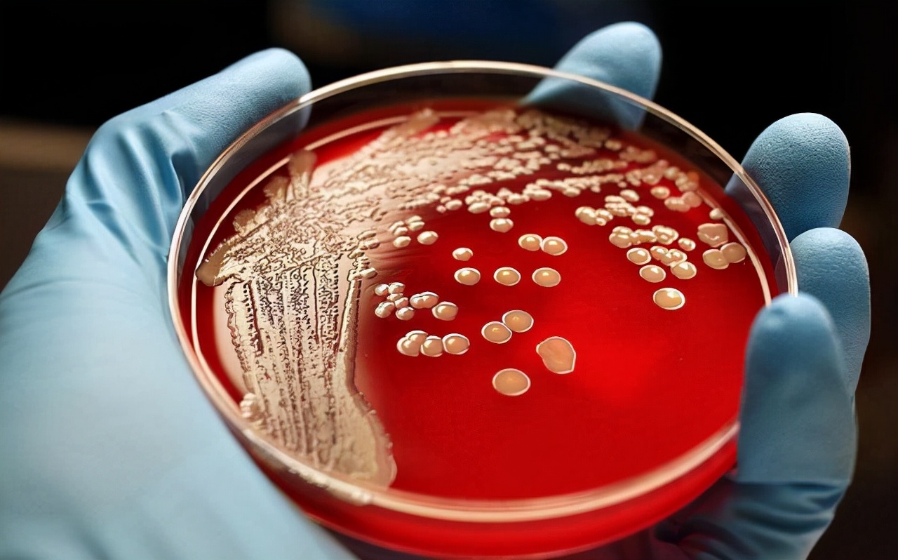 导语:在20世纪40年代时,医学家把红链霉菌分离出红霉素,这是红霉素第1