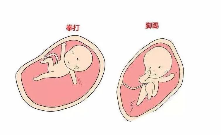胎位图男女男孩图片
