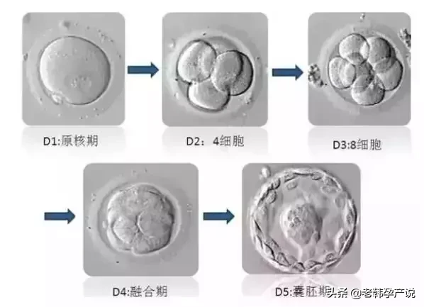 试管婴儿成功率高的医生，这样评估胚胎等级