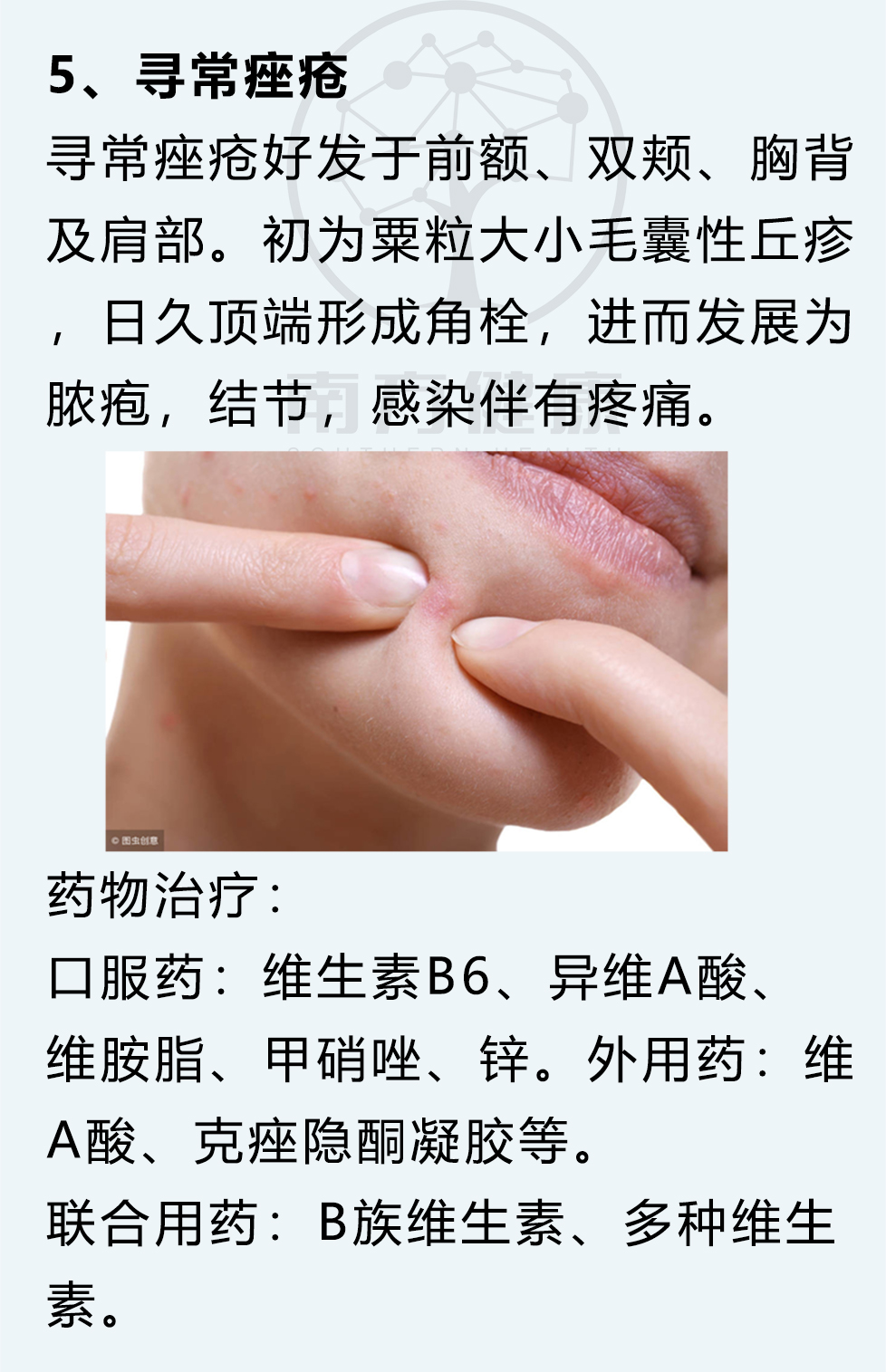 5,寻常性痤疮