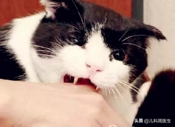 孩子被猫抓挠一下要紧吗？紧急做好伤口处理，与打疫苗同样重要