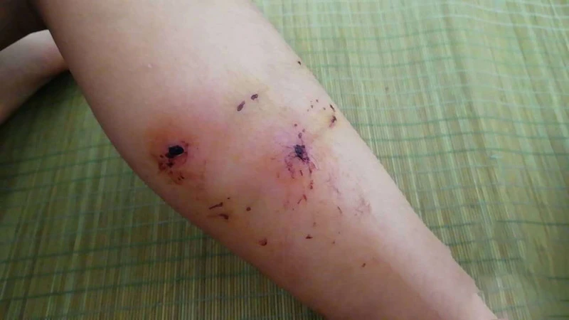 拿命控诉遛狗不牵绳！湖北女子跳楼自杀，被老太围追辱骂近两个月