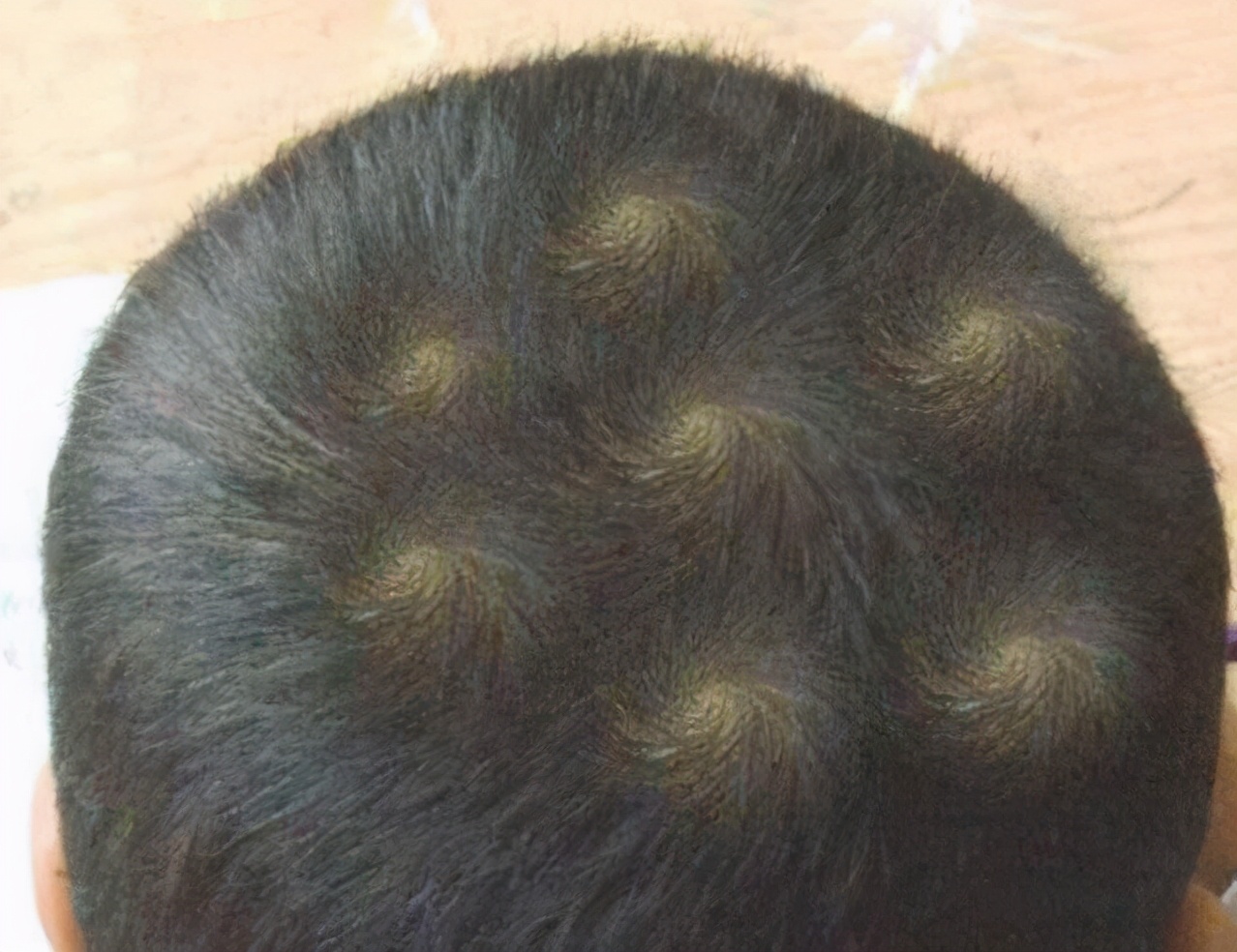 婴儿头发竖起来是什么原因(一旋横俩旋拧) - 乐宝宝贝