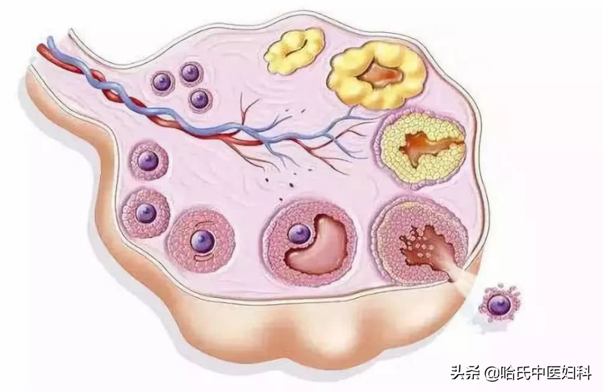 多囊卵巢综合征不孕3年，四次促排失败，拼了命也要生个儿子