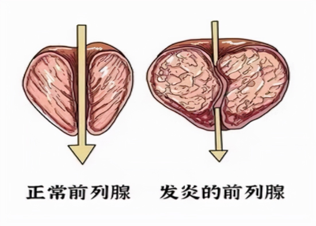 前列腺平滑肌图片