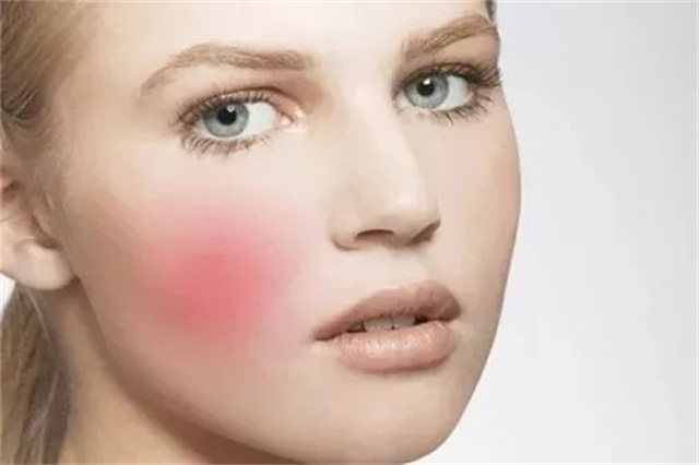 经常感觉干燥紧绷,并且感觉用什么产品都无法缓解;②皮肤脆弱,敏感,对