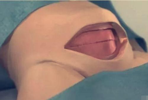 七张过程图带你了解,剖腹产是怎么进行的,看完心疼女人