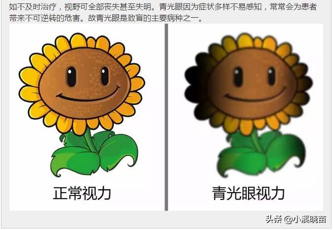 警惕青光眼的五种早期信号