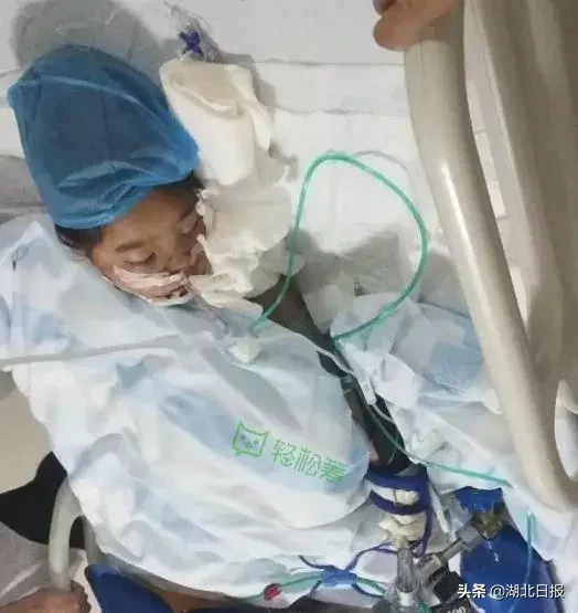 意外连发！鄂州2岁幼童摔成重伤、十堰9岁女孩6楼坠落仍未脱离危险