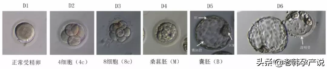 试管婴儿成功率高的医生，这样评估胚胎等级