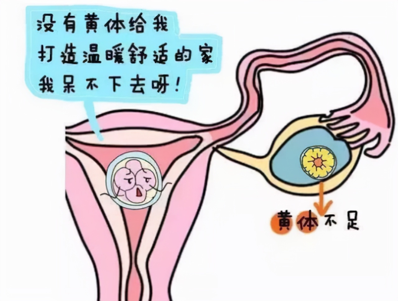 一天接了3个急诊，都是黄体破裂，黄体到底是什么？女性请了解下