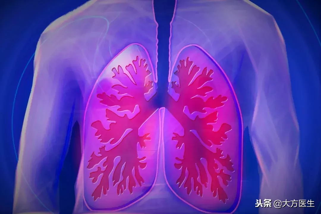 什么是肺癌？你了解它吗？